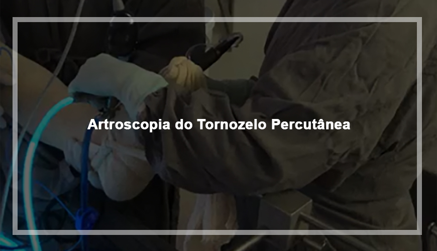 Artroscopia do Tornozelo Percutânea