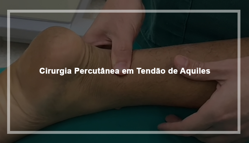Cirurgia Percutânea em Tendão de Aquiles